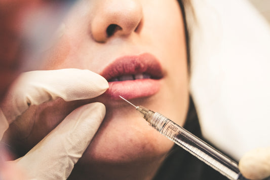 Lip Fillers Before and After: A comprehensive Comparison - Premium Dermal Mart