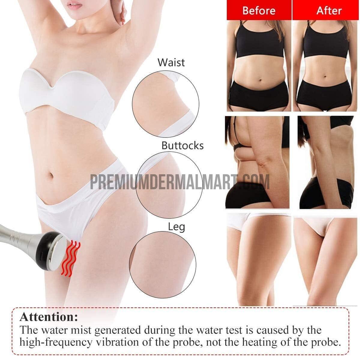 Corff Slimming Cavitation Machine