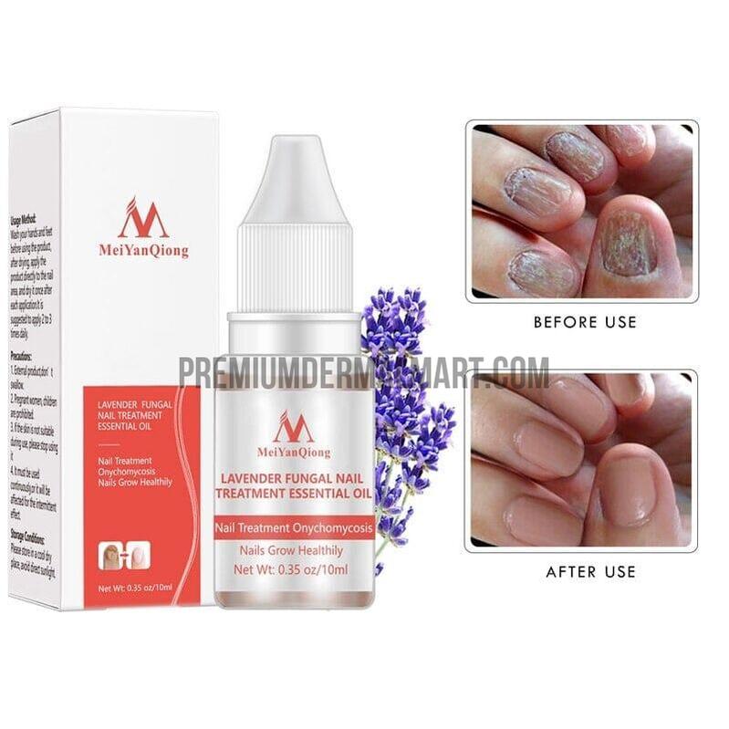 Nail treatment