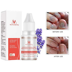 Nail treatment - Premium Dermal Mart