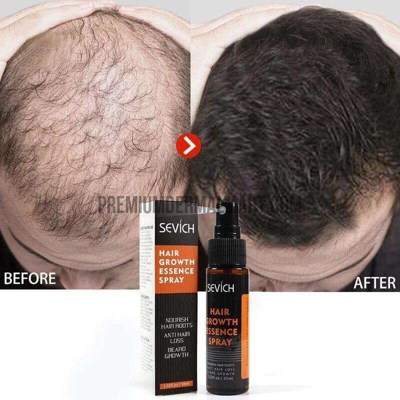 Natural hair loss treatment and Restoration