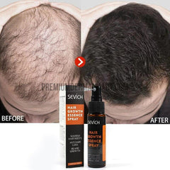 Natural hair loss treatment and Restoration