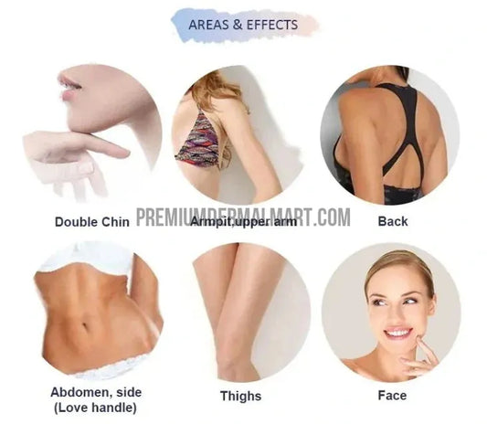 Sculpting Silhouettes: Common Areas Treated with Lipolysis