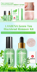 Blackhead removal Cream - Premium Dermal Mart