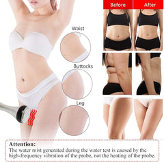 Body Slimming Cavitation Machine - Premium Dermal Mart