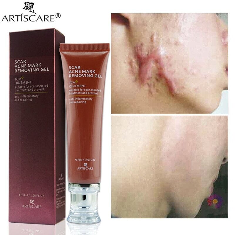 Natural anti scar removal gel - Premium Dermal Mart
